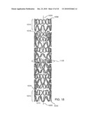 STENT HAVING HELICAL ELEMENTS diagram and image