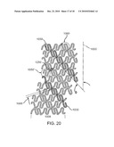 STENT HAVING HELICAL ELEMENTS diagram and image