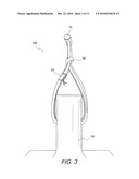 BONE-TENDON-BONE SUTURE BUTTON CONSTRUCTS AND METHODS OF TISSUE FIXATION diagram and image