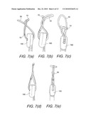 BONE-TENDON-BONE SUTURE BUTTON CONSTRUCTS AND METHODS OF TISSUE FIXATION diagram and image