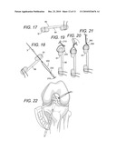 BONE-TENDON-BONE SUTURE BUTTON CONSTRUCTS AND METHODS OF TISSUE FIXATION diagram and image