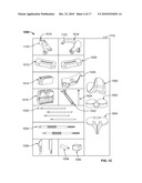 Method and Apparatus for Manufacturing an Implant diagram and image