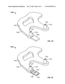 Method and Apparatus for Manufacturing an Implant diagram and image