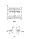 Method and Apparatus for Manufacturing an Implant diagram and image