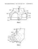 Method and Apparatus for Manufacturing an Implant diagram and image