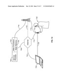 Method and Apparatus for Manufacturing an Implant diagram and image