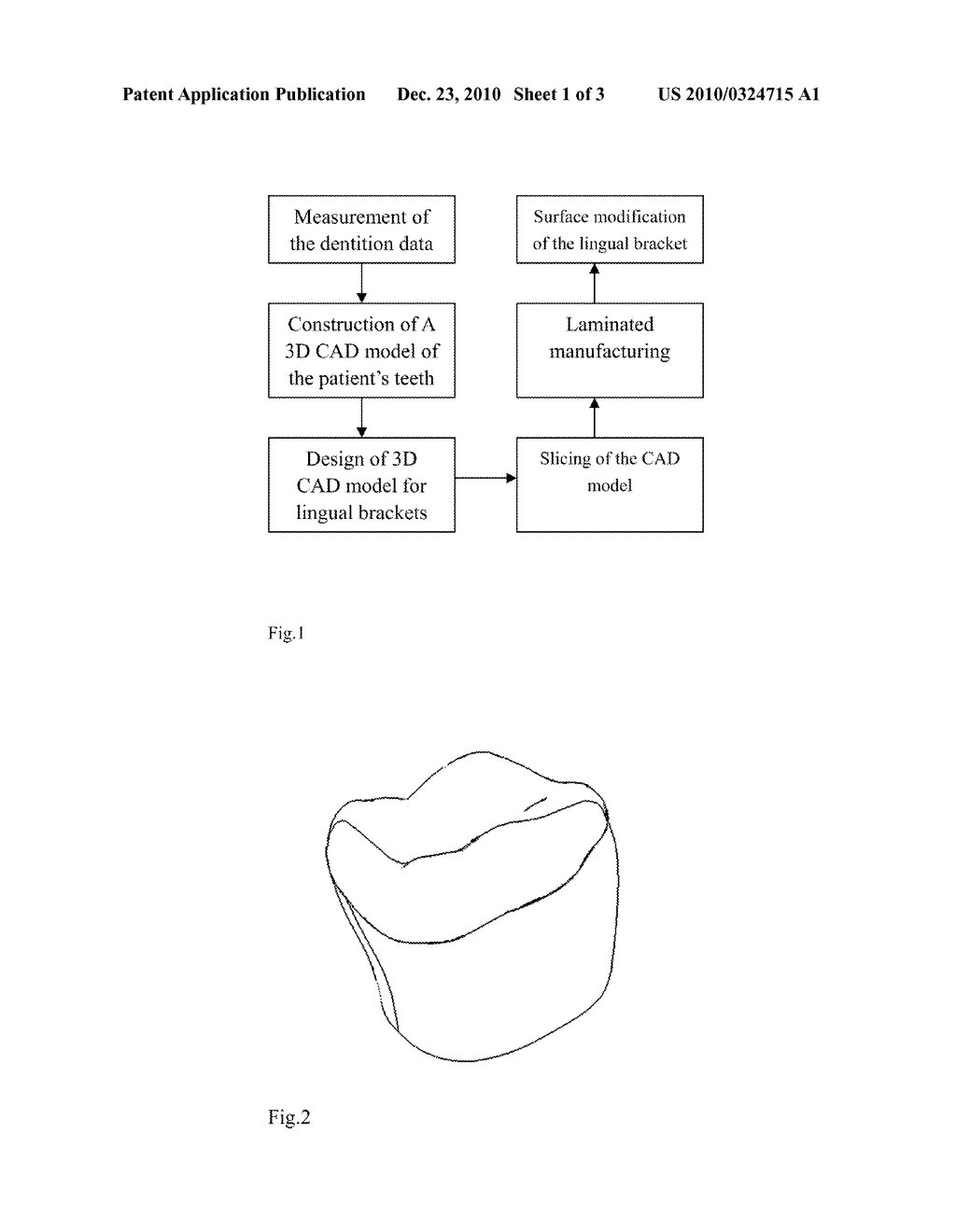 DIRECT MANUFACTURING METHOD OF SELECTIVE LASER MELTING OF CUSTOMIZED TONGUE-SIDE ORTHODONTIC SUPPORT GROOVES - diagram, schematic, and image 02