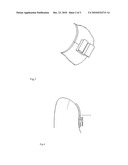 DIRECT MANUFACTURING METHOD OF SELECTIVE LASER MELTING OF CUSTOMIZED TONGUE-SIDE ORTHODONTIC SUPPORT GROOVES diagram and image