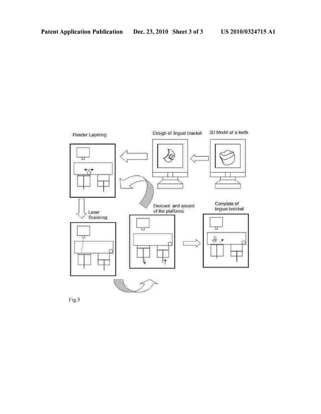 DIRECT MANUFACTURING METHOD OF SELECTIVE LASER MELTING OF CUSTOMIZED TONGUE-SIDE ORTHODONTIC SUPPORT GROOVES - diagram, schematic, and image 04