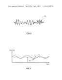 Fluid Responsiveness Measure diagram and image