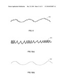 Fluid Responsiveness Measure diagram and image