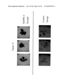 Protein Kinase Stress-Related Proteins and Methods of Use in Plants diagram and image