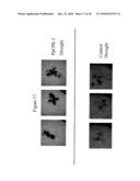 Protein Kinase Stress-Related Proteins and Methods of Use in Plants diagram and image