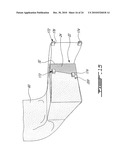 APPARATUS FOR WRAPPING AN ARTICLE AND METHOD FOR DOING SAME diagram and image