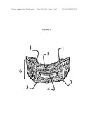 Oral appliance for altitude sickness diagram and image