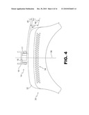 CORRECTION FOR ASYMMETRICAL BUFFING diagram and image