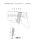 CORRECTION FOR ASYMMETRICAL BUFFING diagram and image