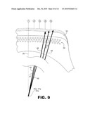 CORRECTION FOR ASYMMETRICAL BUFFING diagram and image