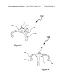 Decorative Article Support diagram and image