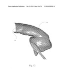 Method and System for Producing Interactive, Three-Dimensional Renderings of Selected Body Organs Having Hollow Lumens to Enable Simulated Movement Through the Lumen diagram and image