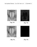 System and Method for a High Dynamic Range Sensitive Sensor Element or Array diagram and image