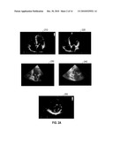 SYSTEMS AND METHODS FOR CARDIAC VIEW RECOGNITION AND DISEASE RECOGNITION diagram and image