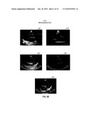 SYSTEMS AND METHODS FOR CARDIAC VIEW RECOGNITION AND DISEASE RECOGNITION diagram and image