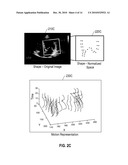 SYSTEMS AND METHODS FOR CARDIAC VIEW RECOGNITION AND DISEASE RECOGNITION diagram and image