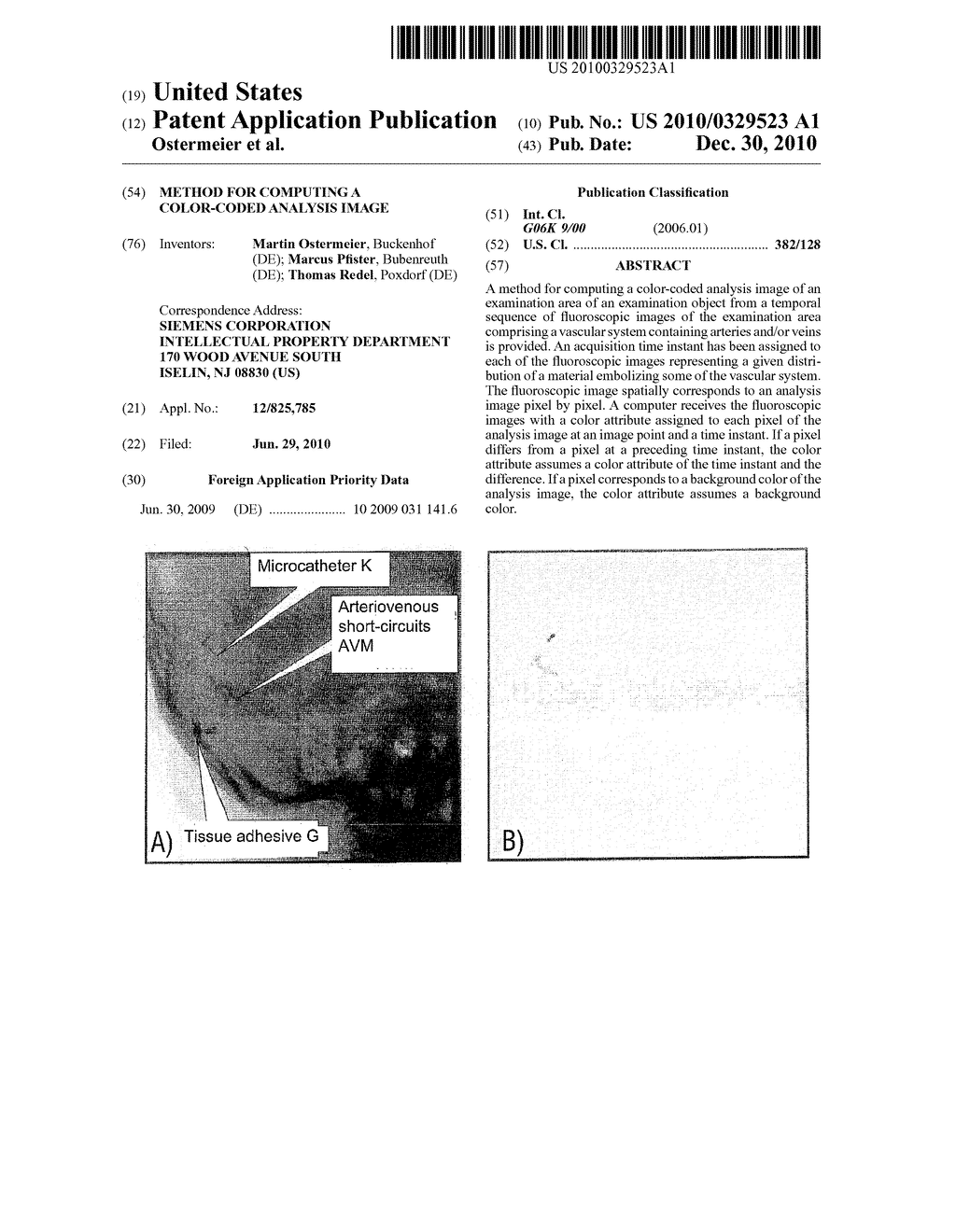 METHOD FOR COMPUTING A COLOR-CODED ANALYSIS IMAGE - diagram, schematic, and image 01