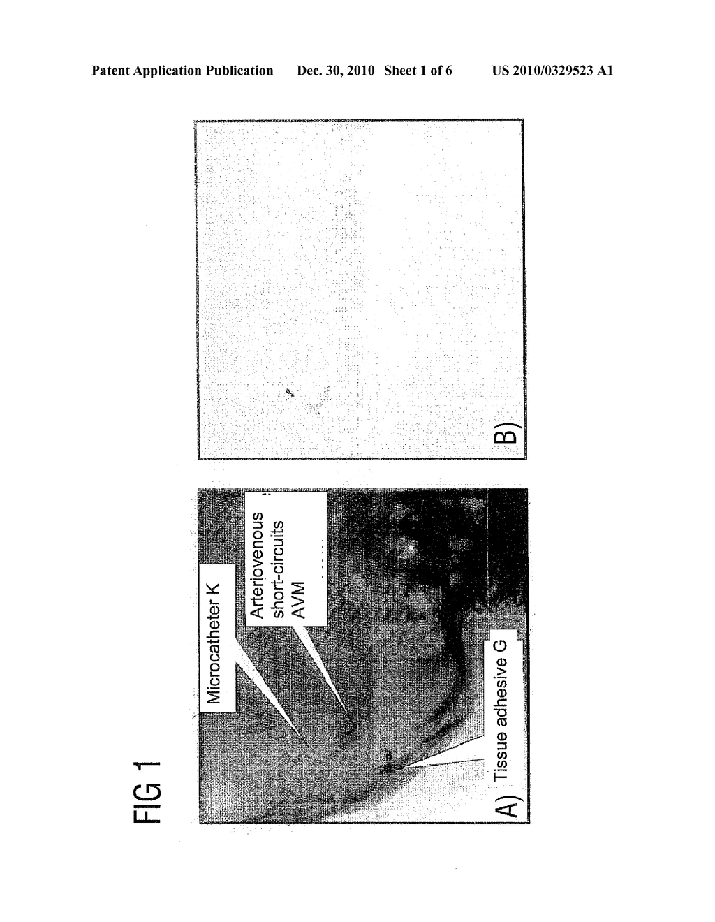 METHOD FOR COMPUTING A COLOR-CODED ANALYSIS IMAGE - diagram, schematic, and image 02