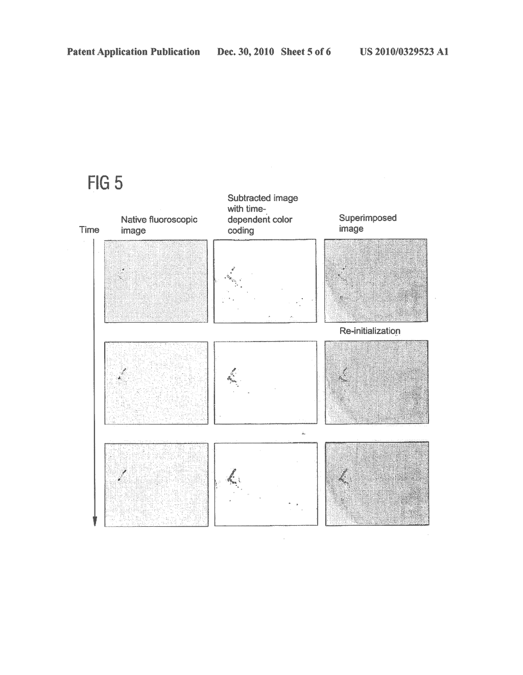 METHOD FOR COMPUTING A COLOR-CODED ANALYSIS IMAGE - diagram, schematic, and image 06