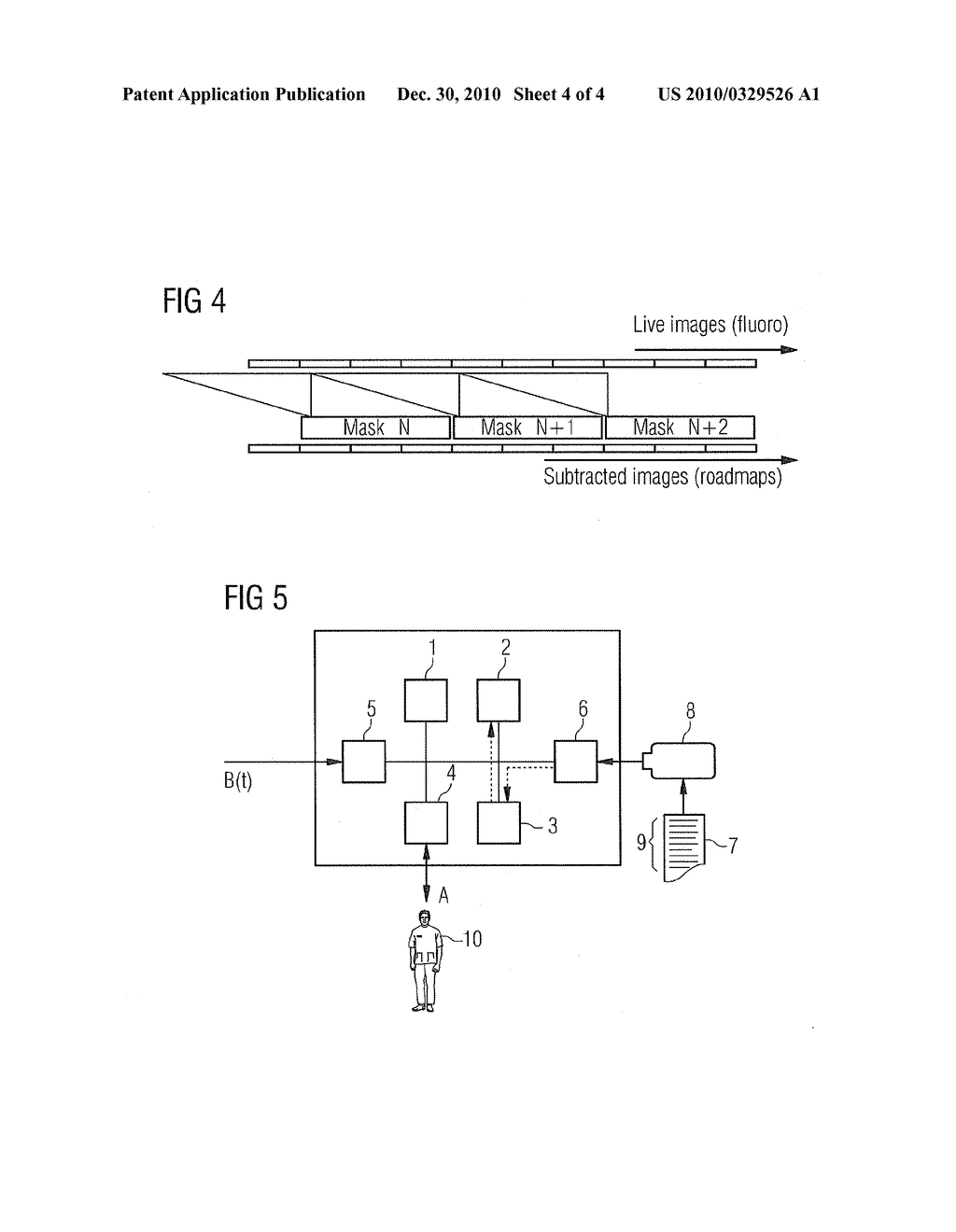 Determination method for a reinitialization of a temporal sequence of fluoroscopic images of an examination region of an examination object - diagram, schematic, and image 05