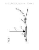 Controlled bending of pipeline by external force diagram and image