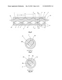 PROGRESSING CAVITY PUMP ADAPTED FOR PUMPING OF COMPRESSIBLE FLUIDS diagram and image