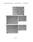 Mesenchymal Stem Cells Grown Under Hypoxic Conditions: Compositions, Methods and Uses Therefor diagram and image