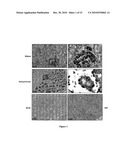 KLOTHO PROTEIN AND RELATED COMPOUNDS FOR THE TREATMENT AND DIAGNOSIS OF CANCER diagram and image