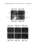 METHODS AND COMPOSITONS FOR ANTISENSE VEGF OLIGONUCLEOTIDES diagram and image