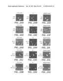 METHODS AND COMPOSITONS FOR ANTISENSE VEGF OLIGONUCLEOTIDES diagram and image