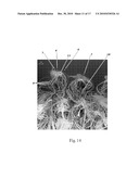 TUFTED FIBROUS WEB diagram and image