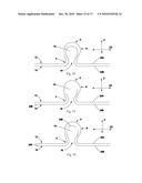 TUFTED FIBROUS WEB diagram and image