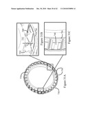 POLISHING PAD WITH ARRAY OF FLUIDIZED GIMBALLED ABRASIVE MEMBERS diagram and image