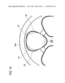 CENTRIFUGAL SEPARATOR diagram and image