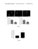 METHODS AND COMPOSITIONS FOR TREATING ISCHEMIC STROKE diagram and image