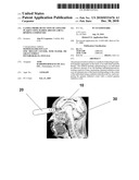 GAMMA PROBE DETECTION OF AMYLOID PLAQUE USING RADIOLABELED A-BETA BINDING COMPOUNDS diagram and image