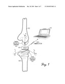 ZERO-CROSSING RECEIVER FOR ORTHOPEDIC PARAMETER SENSING diagram and image