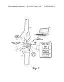 DEVICE AND METHOD FOR ADVANCED LOW-POWER MANAGEMENT OF A SENSOR TO MEASURE A PARAMETER OF THE MUSCULAR-SKELETAL SYSTEM diagram and image