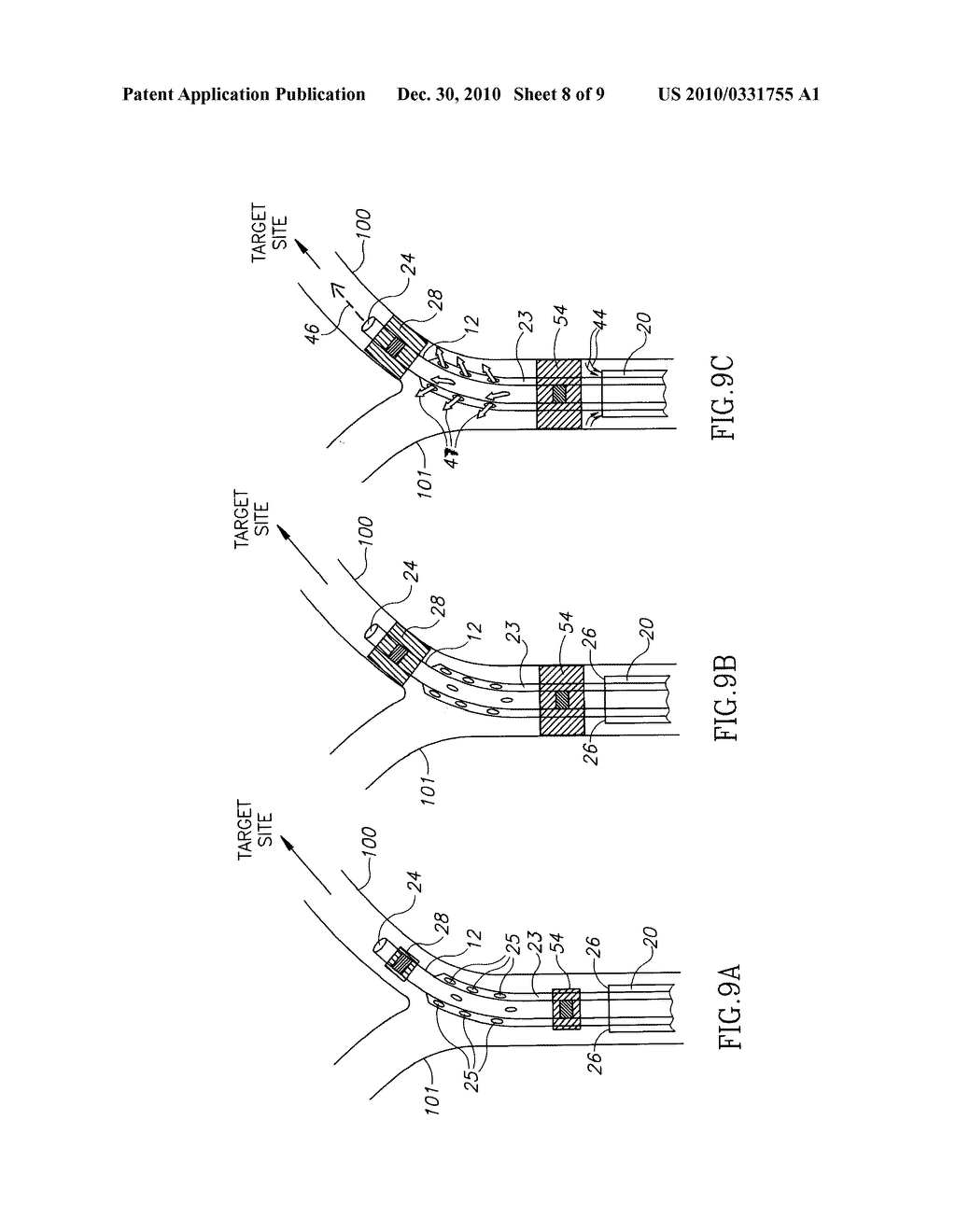 METHODS FOR SELECTIVE THERMAL TREATMENT - diagram, schematic, and image 09