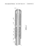 ULTRASOUND CATHETER WITH EMBEDDED CONDUCTORS diagram and image