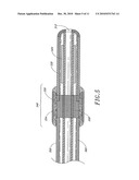 ULTRASOUND CATHETER WITH EMBEDDED CONDUCTORS diagram and image