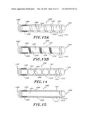 ULTRASOUND CATHETER WITH EMBEDDED CONDUCTORS diagram and image